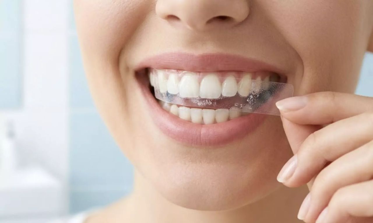 Benzi de albire acasă: Ghid complet pentru un zâmbet strălucitor