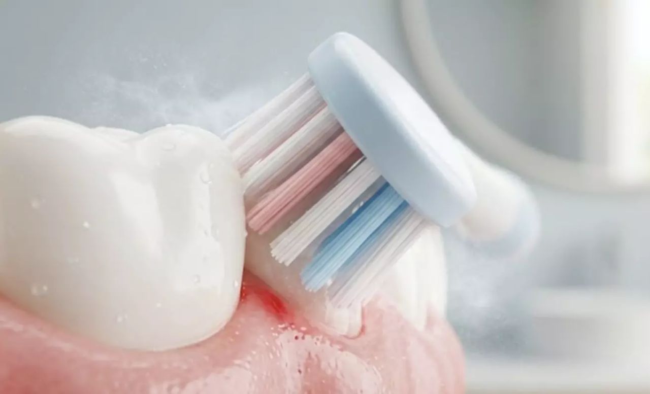 De ce sângerează gingiile la periaj? Cauze, riscuri și tratament eficient