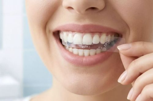 Benzi de albire acasă: Ghid complet pentru un zâmbet strălucitor