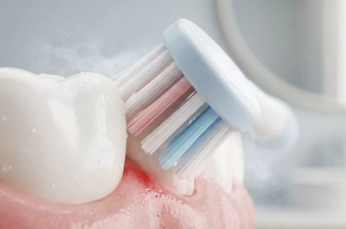 De ce sângerează gingiile la periaj? Cauze, riscuri și tratament eficient